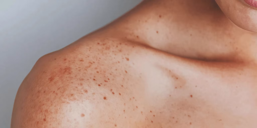 Imagen hiperrealista de la piel de una mujer que muestra las imperfecciones de la piel
